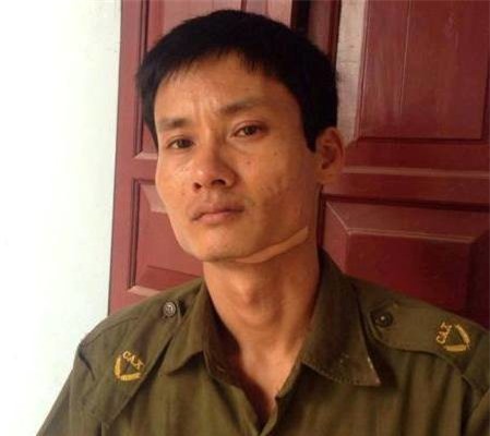 Rùng mình phút nam thanh niên đánh người, dùng dao cứa cổ công an