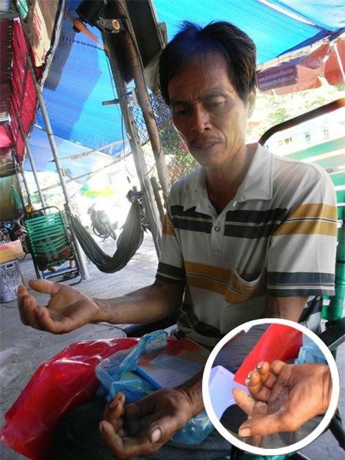 Bắt kẻ chém gục hai vợ chồng hàng xóm rồi vào viện tâm thần chữa bệnh