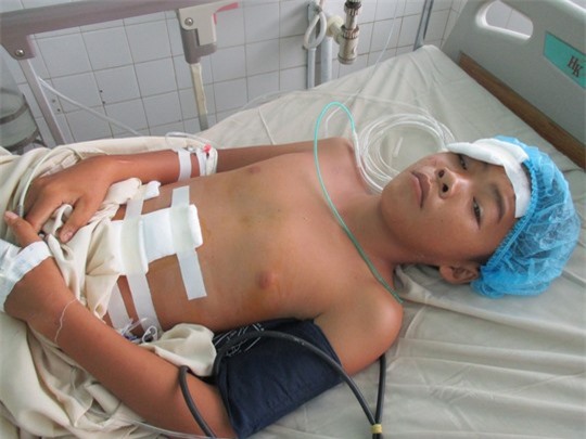 Nam sinh lớp 7 bị vỡ gan do xe đạp bất ngờ gãy cổ