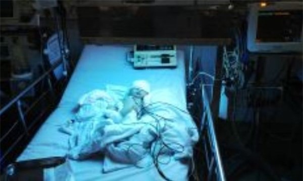 Cuộc chiến giành sự sống cho bé gái sơ sinh mắc sốt xuất huyết