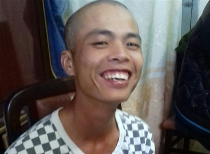 Đưa bị can giám định tâm thần