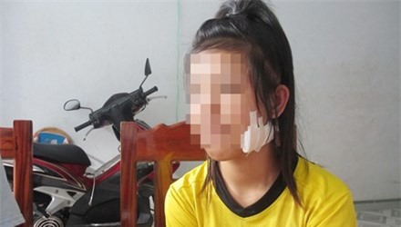 Nữ sinh lớp 9 bất ngờ bị "đàn em" lớp 7 rạch mặt