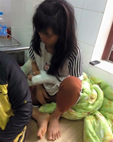 Bé gái lớp 9 bị bố đẻ đánh bầm dập khắp người