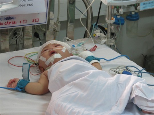 Bé trai bị đâm xuyên sọ: Hồi tỉnh sau ca mổ cắt ổ vi trùng