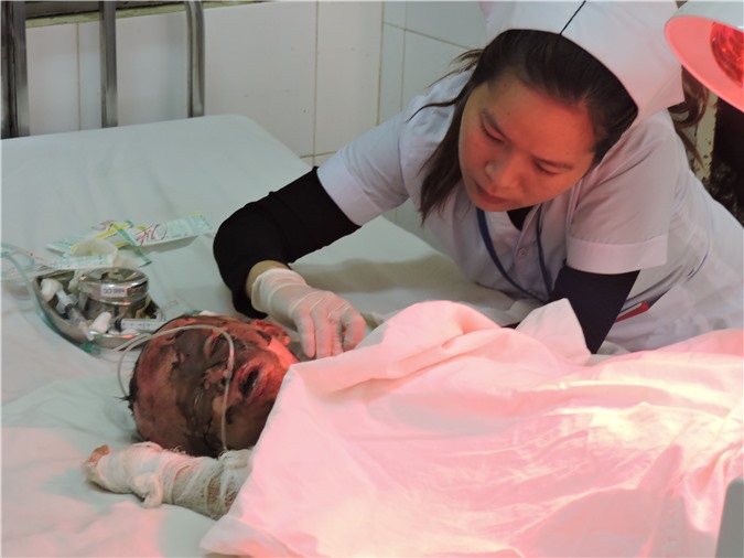 Một phút lỡ đãng, người mẹ và đứa con 13 tháng tuổi cùng nhập viện