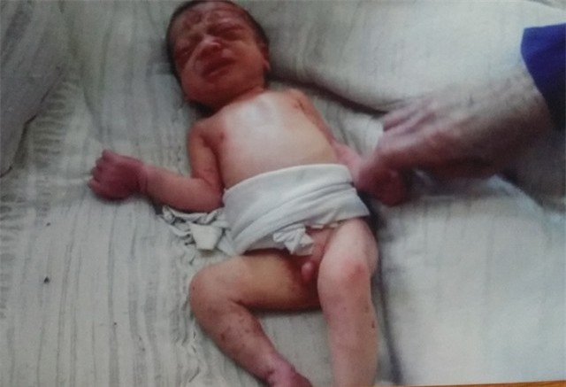 Bé sơ sinh bị bỏ rơi, kiến đốt khắp cơ thể hồi sinh kỳ diệu