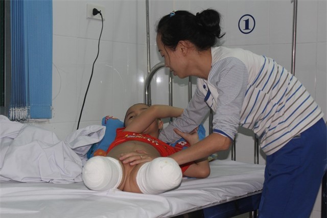 Mẹ ơi, chân của con đâu rồi?