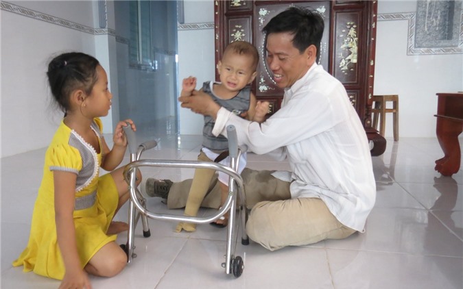 Bé sơ sinh văng khỏi bụng mẹ bước đi với chân giả sau 1 năm