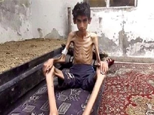 Thảm cảnh khốn cùng của 40.000 người dân Syria vùng chiến sự