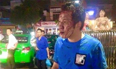 Bảo vệ siêu thị Emart đánh người vì dám chen lấn trong bãi xe