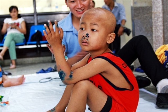 Ứa nước mắt cảnh bố trẻ chăm các con ung thư, bại não