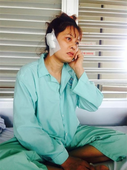 Hy hữu, người phụ nữ bị chồng cắn đứt tai