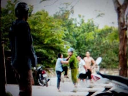 Phó Công an huyện bị trộm chém trọng thương