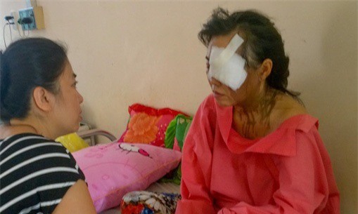 Vụ chồng cũ thuê người tạt axít vợ: Nạn nhân nói gì?