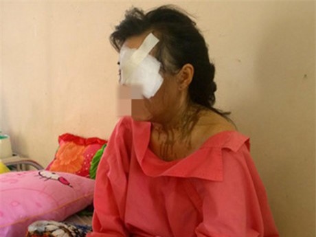 Vụ thuê người tạt axit: Vợ đau đớn biết chồng cũ là chủ mưu