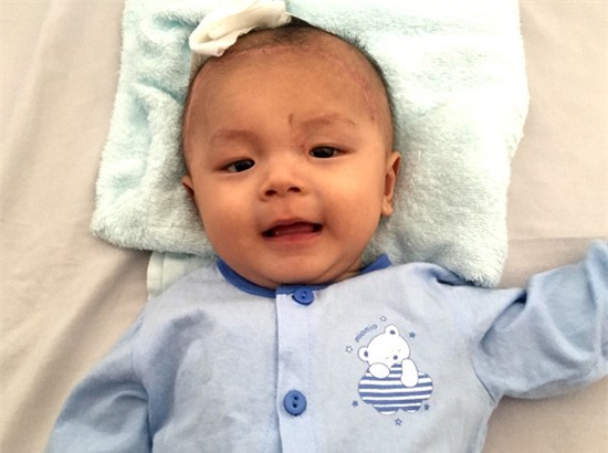 Bé bị đâm xuyên sọ tươi tỉnh về nhà đón Tết