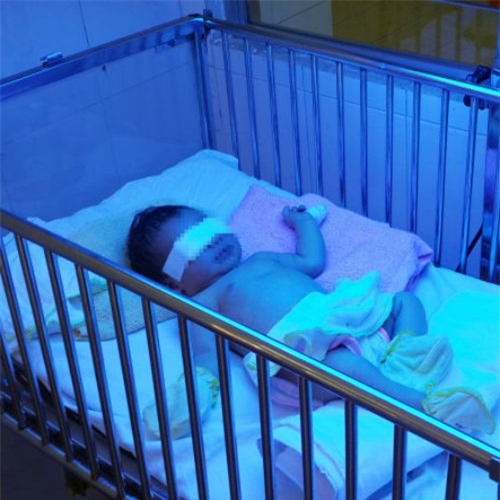 Đồng Nai: Bé sơ sinh bị mẹ cắn đứt ngón tay 