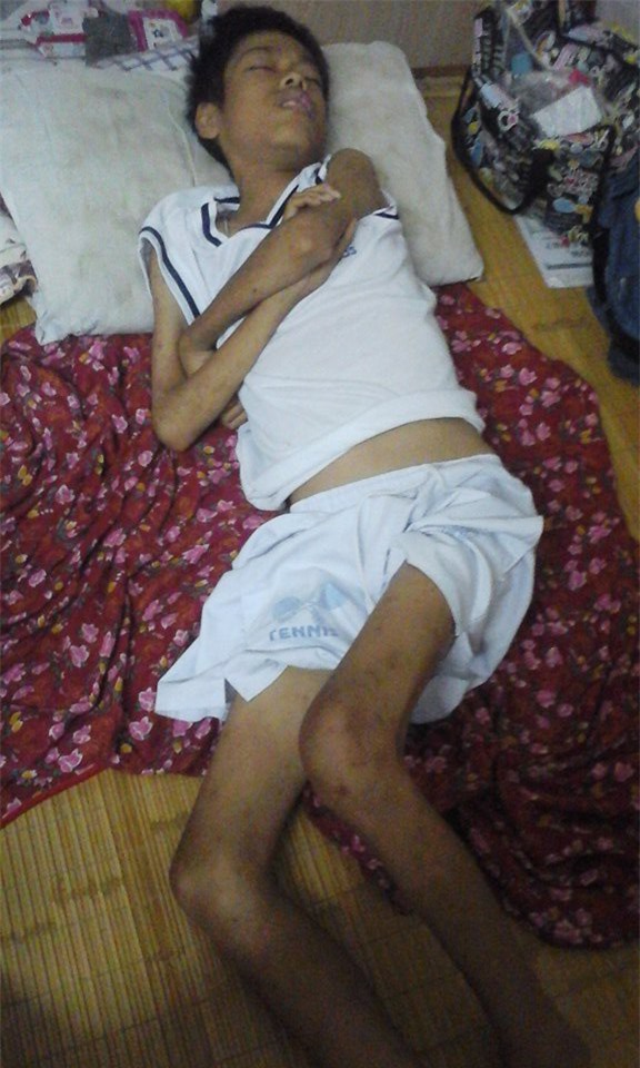 Cậu bé 15 năm giành giật… sự sống