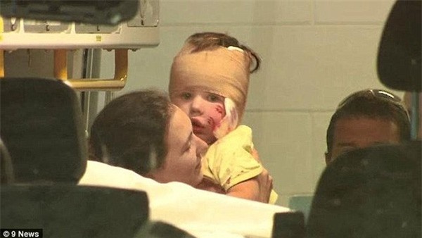 Cậu bé 3 tuổi khóc thét, hoảng loạn vì bị chó pit bull tấn công