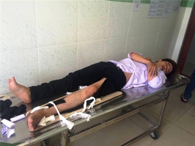 TP. HCM: Hai thanh niên chạy xe như điên tông gãy chân CSGT