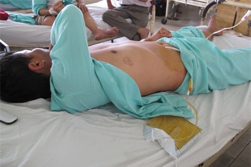 Tự tay cắt "của quý" để không phải lấy vợ vì áp lực gia đình