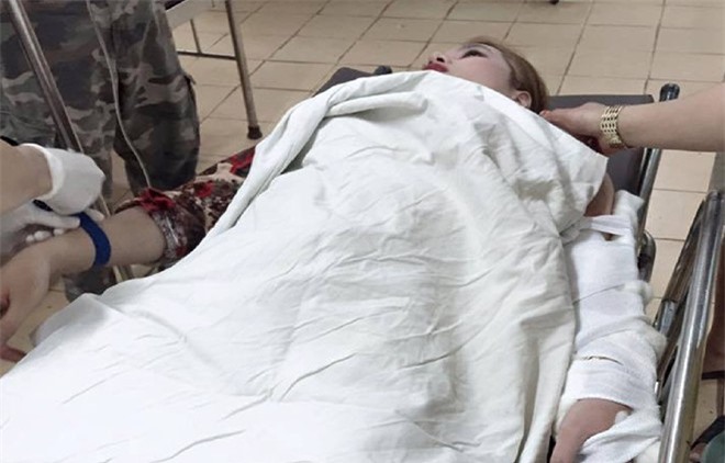 Bàng hoàng cô gái bị cướp giật cắt đứt 4 gân tay