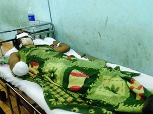 Cuốc phải mìn, bị nổ cụt tay và hỏng mắt