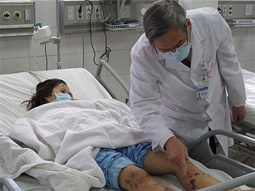 Bệnh viêm não mô cầu cực nguy hiểm "tấn công"  Hà Nội