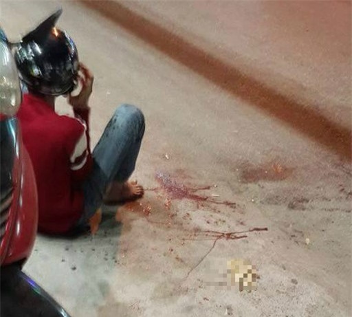 Côn đồ truy sát, thanh niên bị chém đứt lìa bàn tay