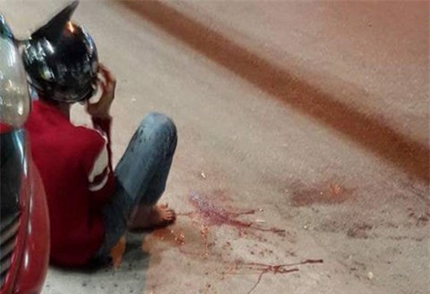 Vụ côn đồ truy sát chém đứt lìa bàn tay: Nạn nhân bị chém nhầm vì đi chung nhóm 