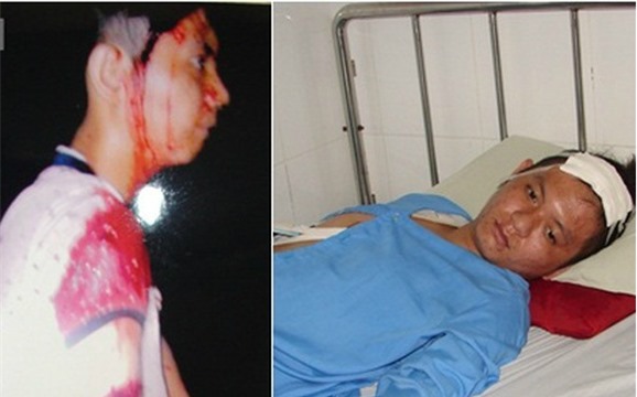 Côn đồ cầm mã tấu lao vào nhà, chém xối xả một thanh niên