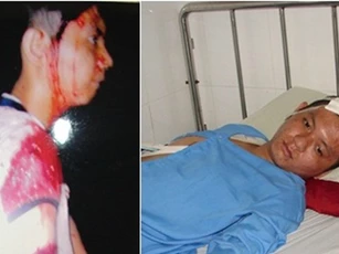 Côn đồ cầm mã tấu lao vào nhà, chém xối xả một thanh niên