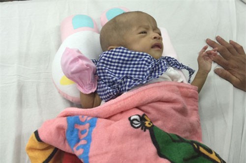 Lọt lòng mẹ cặp song sinh đã nằm viện