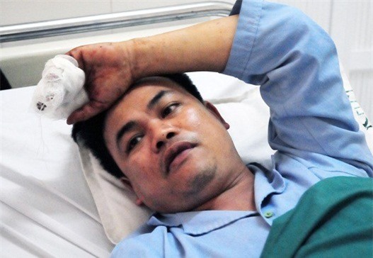 Vụ tai nạn xe khách đâm xe bồn: Tình tiết đáng chú ý