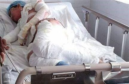 Nghi án chồng tẩm xăng đốt vợ vì mâu thuẫn