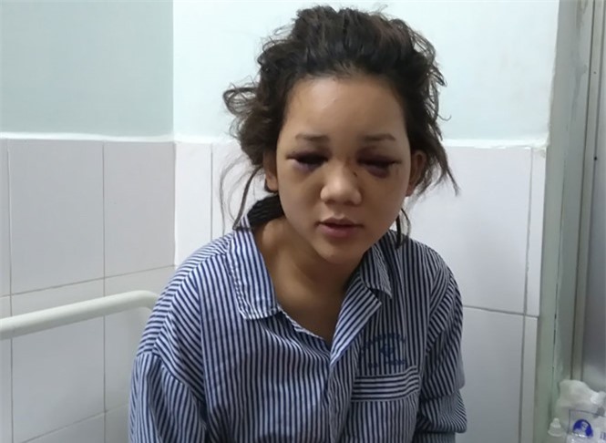 Thiếu úy Cảnh sát đánh bạn gái chấn thương sọ não: Công an vào cuộc điều tra