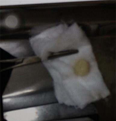 Người nhà "tố" bác sĩ BV ĐK Chương Mỹ "tắc trách" làm chết bệnh nhi 2 tuổi?