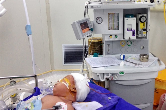 Sốc: Bé sơ sinh hơn 1 tháng tuổi bị dao quắm xuyên trán