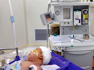 Sốc: Bé sơ sinh hơn 1 tháng tuổi bị dao quắm xuyên trán