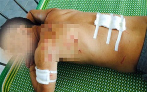 Ôm hận 1 năm ròng, gã trai dùng dao truy sát bạn