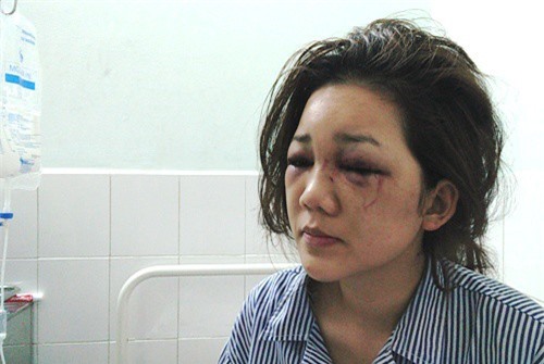 Thiếu úy công an đánh bạn gái nhập viện muốn "giải quyết nội bộ"?