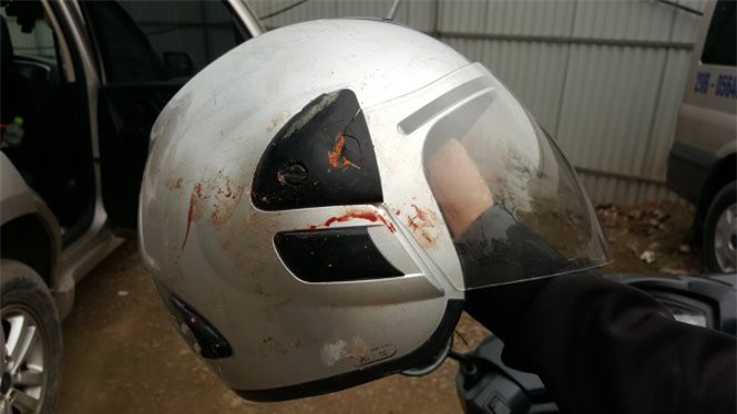 Đề nghị Công an điều tra vụ nhà báo Đỗ Doãn Hoàng bị đánh