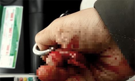 Nhà báo Đỗ Doãn Hoàng bị 3 kẻ lạ mặt hành hung