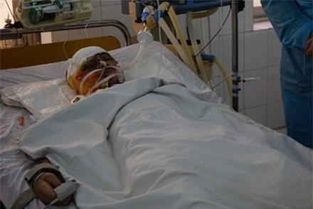 Nạn nhân nữ ngồi trên xe tải trong vụ nổ ở Hà Đông vẫn hôn mê sâu