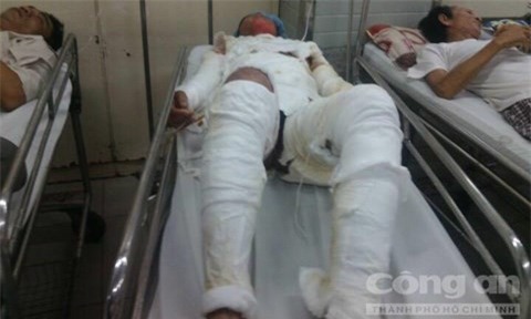 Người phụ nữ bị chồng nát rượu thiêu sống tử vong