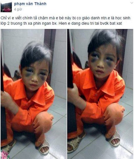 Vụ bé gái bị đánh bầm tím mặt vì viết chậm: Đề nghị kỷ luật cô giáo 