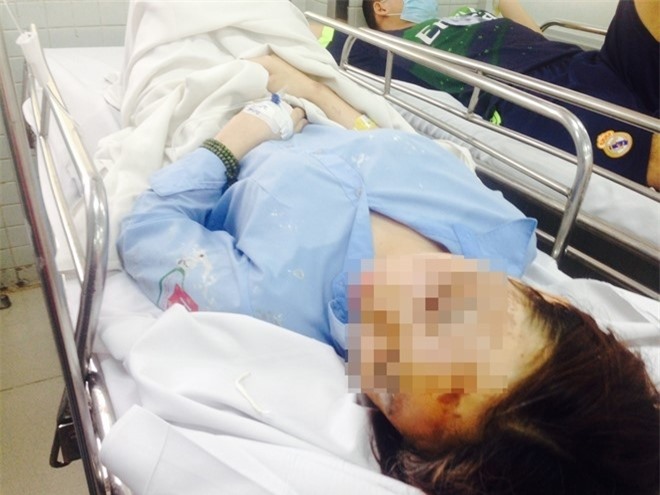 Vụ tạt axit làm nữ sinh mù mắt: Tình tiết mới nhất