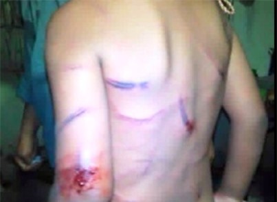 Bé 7 tuổi bị cha dượng đánh đập tàn nhẫn trong công viên