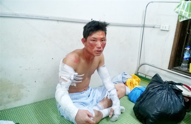 Nghệ An: Nổ  lớn tại nhà máy tinh bột sắn, 5 người bị thương nặng