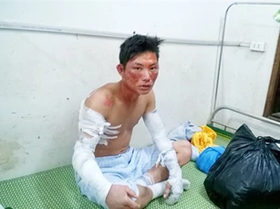 Nghệ An: Nổ  lớn tại nhà máy tinh bột sắn, 5 người bị thương nặng